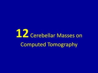 12Cerebellar Masses on
Computed Tomography
 