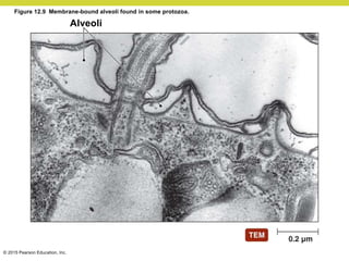 © 2015 Pearson Education, Inc.
Figure 12.9 Membrane-bound alveoli found in some protozoa.
Alveoli
 