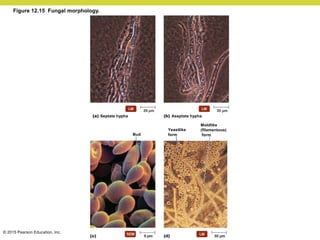 © 2015 Pearson Education, Inc.
Aseptate hypha
Moldlike
(filamentous)
form
Bud
Septate hypha
Yeastlike
form
Figure 12.15 Fungal morphology.
 