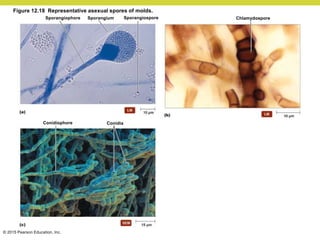 © 2015 Pearson Education, Inc.
Sporangiospore
Sporangiophore Sporangium Chlamydospore
Conidiophore Conidia
Figure 12.18 Representative asexual spores of molds.
 
