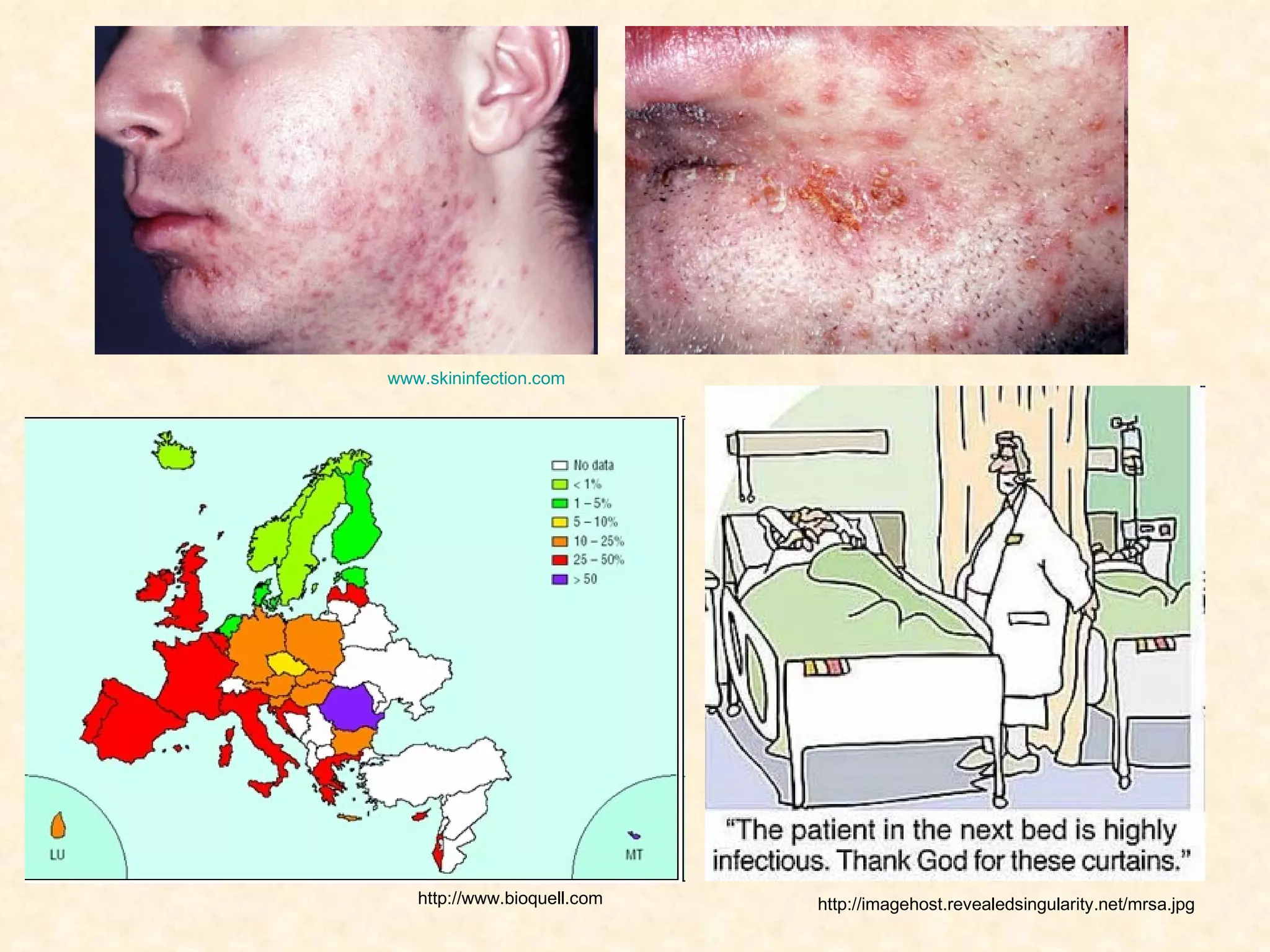 www.skininfection.com   http://imagehost.revealedsingularity.net/mrsa.jpg http://www.bioquell.com   