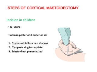 STEPS OF CORTICAL MASTOIDECTOMY
• <2 years
• Incision posterior & superior as:
1. Stylomastoid foramen shallow
2. Tympanic ring incomplete
3. Mastoid not pneumatized
Incision in children
 