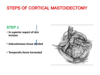 STEPS OF CORTICAL MASTOIDECTOMY
STEP 3
• In superior aspect of skin
incision
• Subcutaneous tissue divided
• Temporalis fascia harvested
 