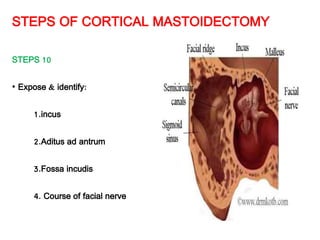 STEPS OF CORTICAL MASTOIDECTOMY
STEPS 10
• Expose & identify:
1.incus
2.Aditus ad antrum
3.Fossa incudis
4. Course of facial nerve
 
