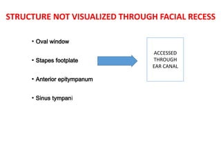 STRUCTURE NOT VISUALIZED THROUGH FACIAL RECESS
• Oval window
• Stapes footplate
• Anterior epitympanum
• Sinus tympani
ACCESSED
THROUGH
EAR CANAL
 