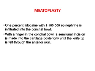MEATOPLASTY
•One percent lidocaine with 1:100,000 epinephrine is
infiltrated into the conchal bowl.
•With a finger in the conchal bowl, a semilunar incision
is made into the cartilage posteriorly until the knife tip
is felt through the anterior skin.
 