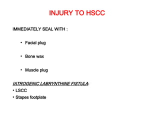 INJURY TO HSCC
IMMEDIATELY SEAL WITH :
• Facial plug
• Bone wax
• Muscle plug
IATROGENIC LABRYNTHINE FISTULA:
• LSCC
• Stapes footplate
 