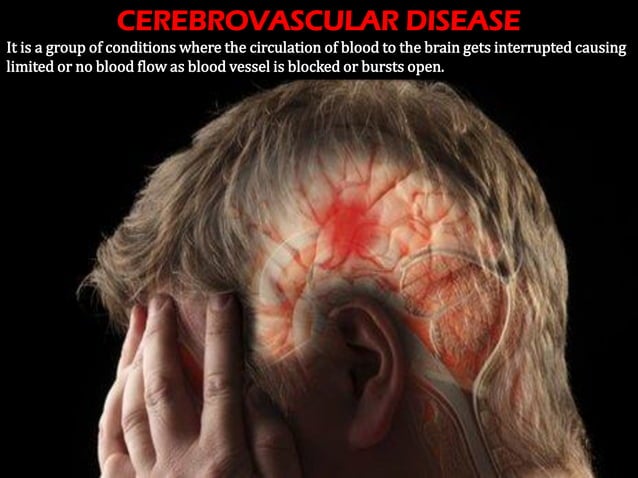 12 DEADLY HUMAN DISEASES OF ALL TIME