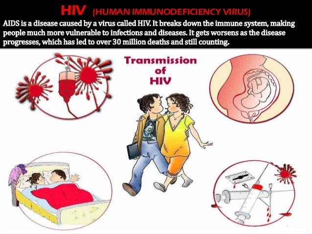 HIV (HUMAN IMMUNODEFICIENCY VIRUS) AIDS