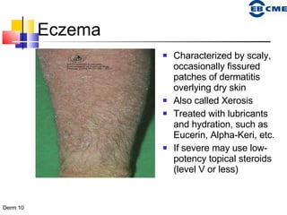 Eczema Characterized by scaly, occasionally fissured patches of dermatitis overlying dry skin Also called Xerosis  Treated with lubricants and hydration, such as Eucerin, Alpha-Keri, etc.  If severe may use low- potency topical steroids (level V or less) 