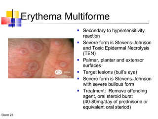 Erythema Multiforme Secondary to hypersensitivity reaction Severe form is Stevens-Johnson and Toxic Epidermal Necrolysis (TEN) Palmar, plantar and extensor surfaces Target lesions (bull’s eye) Severe form is Stevens-Johnson with severe bullous form Treatment:  Remove offending agent, oral steroid burst (40-80mg/day of prednisone or equivalent oral steriod) 