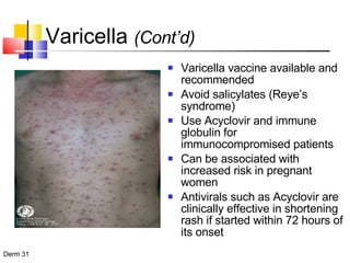 Varicella  (Cont’d) Varicella vaccine available and recommended Avoid salicylates (Reye’s syndrome) Use Acyclovir and immune globulin for immunocompromised patients Can be associated with increased risk in pregnant women Antivirals such as Acyclovir are clinically effective in shortening rash if started within 72 hours of its onset 