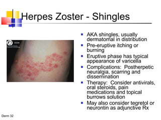 Herpes Zoster - Shingles AKA shingles, usually dermatomal in distribution Pre-eruptive itching or burning Eruptive phase has typical appearance of varicella Complications:  Postherpetic neuralgia, scarring and dissemination Therapy:  Consider antivirals, oral steroids, pain medications and topical burrows solution May also consider tegretol or neurontin as adjunctive Rx 