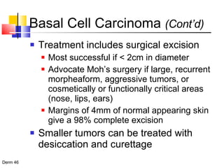 Treatment includes surgical excision Most successful if < 2cm in diameter Advocate Moh’s surgery if large, recurrent morpheaform, aggressive tumors, or cosmetically or functionally critical areas (nose, lips, ears) Margins of 4mm of normal appearing skin give a 98% complete excision Smaller tumors can be treated with desiccation and curettage  Basal Cell Carcinoma  (Cont’d) 