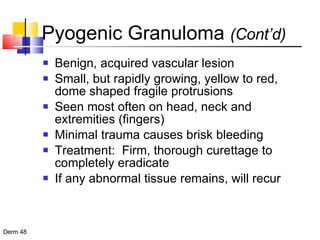 Pyogenic Granuloma  (Cont’d) Benign, acquired vascular lesion Small, but rapidly growing, yellow to red, dome shaped fragile protrusions Seen most often on head, neck and extremities (fingers) Minimal trauma causes brisk bleeding Treatment:  Firm, thorough curettage to completely eradicate If any abnormal tissue remains, will recur 