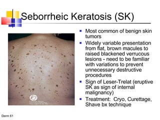 Seborrheic Keratosis (SK) Most common of benign skin tumors Widely variable presentation from flat, brown macules to raised blackened verrucous lesions - need to be familiar with variations to prevent unnecessary destructive procedures Sign of Leser-Trelat (eruptive SK as sign of internal malignancy) Treatment:  Cryo, Curettage, Shave bx technique  