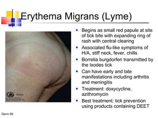 Erythema Migrans (Lyme) Begins as small red papule at site of tick bite with expanding ring of rash with central clearing Associated flu-like symptoms of H/A, stiff neck, fever, chills Borrelia burgdorferi transmitted by the Ixodes tick Can have early and late manifestations including arthritis and meningitis  Treatment: doxycycline, azithromycin Best treatment: tick prevention using products containing DEET 