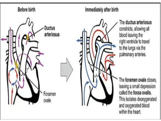 12 Development of the Cardiovascular System (2).pptx