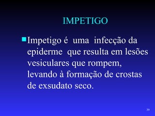 IMPETIGO
 Impetigo é uma infecção da
 epiderme que resulta em lesões
 vesiculares que rompem,
 levando à formação de crostas
 de exsudato seco.

                              39
 