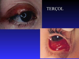 TERÇOL




         47
 