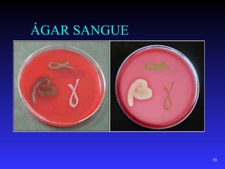 ÁGAR SANGUE




              58
 