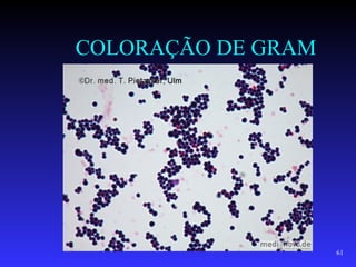COLORAÇÃO DE GRAM




                    61
 
