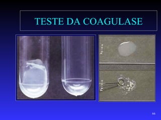 TESTE DA COAGULASE




                     66
 