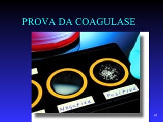 PROVA DA COAGULASE




                     67
 