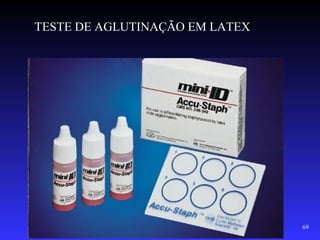 TESTE DE AGLUTINAÇÃO EM LATEX




                                69
 