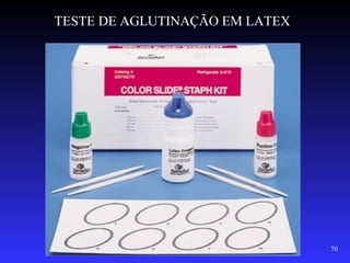 TESTE DE AGLUTINAÇÃO EM LATEX




                                70
 