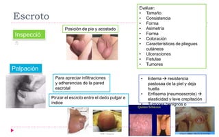 Escroto
Inspecció
n
Posición de pie y acostado
Evaluar:
• Tamaño
• Consistencia
• Forma
• Asimetría
• Forma
• Coloración
• Características de pliegues
cutáneos
• Ulceraciones
• Fistulas
• Tumores
Palpación
Para apreciar infiltraciones
y adherencias de la pared
escrotal
Pinzar el escroto entre el dedo pulgar e
índice
• Edema  resistencia
pastosaa de la piel y deja
huella
• Enfisema (neumoescroto) 
elasticidad y leve crepitación
• Tumores benignos o
malignos
 