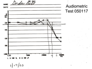 Audiometric
Test 050117
 