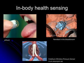 In-body health sensing




pillcam                      Nanobot in the bloodstream




                       EndoSure Wireless Pressure Sensor
                       in an aneurysm sac
 