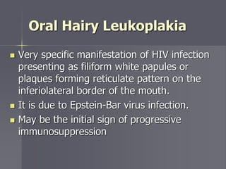 Oral Hairy Leukoplakia
 Very specific manifestation of HIV infection
presenting as filiform white papules or
plaques forming reticulate pattern on the
inferiolateral border of the mouth.
 It is due to Epstein-Bar virus infection.
 May be the initial sign of progressive
immunosuppression
 