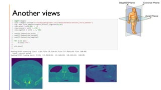 Images are array for medical image processing | PDF