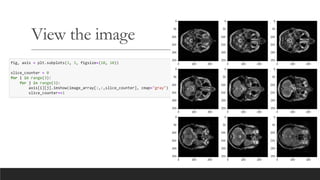 Images are array for medical image processing | PDF