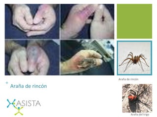 +	
  	
  
Araña	
  de	
  rincón	
  
Araña	
  de	
  rincón	
  
Araña	
  del	
  trigo	
  
 