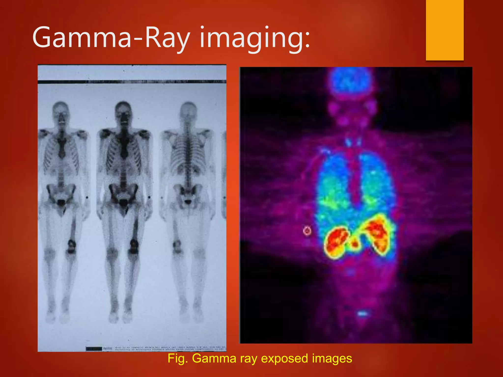 Gamma-Ray imaging:
Fig. Gamma ray exposed images
 