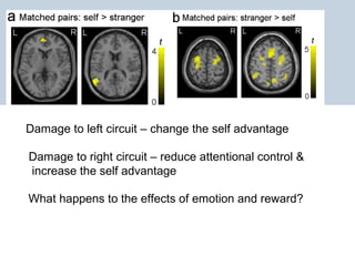January 19, 2015Presentation title, edit in
header and footer
(view menu)
Page 37
Damage to left circuit – change the self advantage
Damage to right circuit – reduce attentional control &
increase the self advantage
What happens to the effects of emotion and reward?
 
