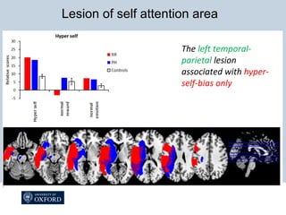 The left temporal-
parietal lesion
associated with hyper-
self-bias only
Lesion of self attention area
 