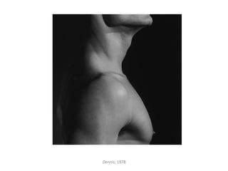 Dennis, 1978
 