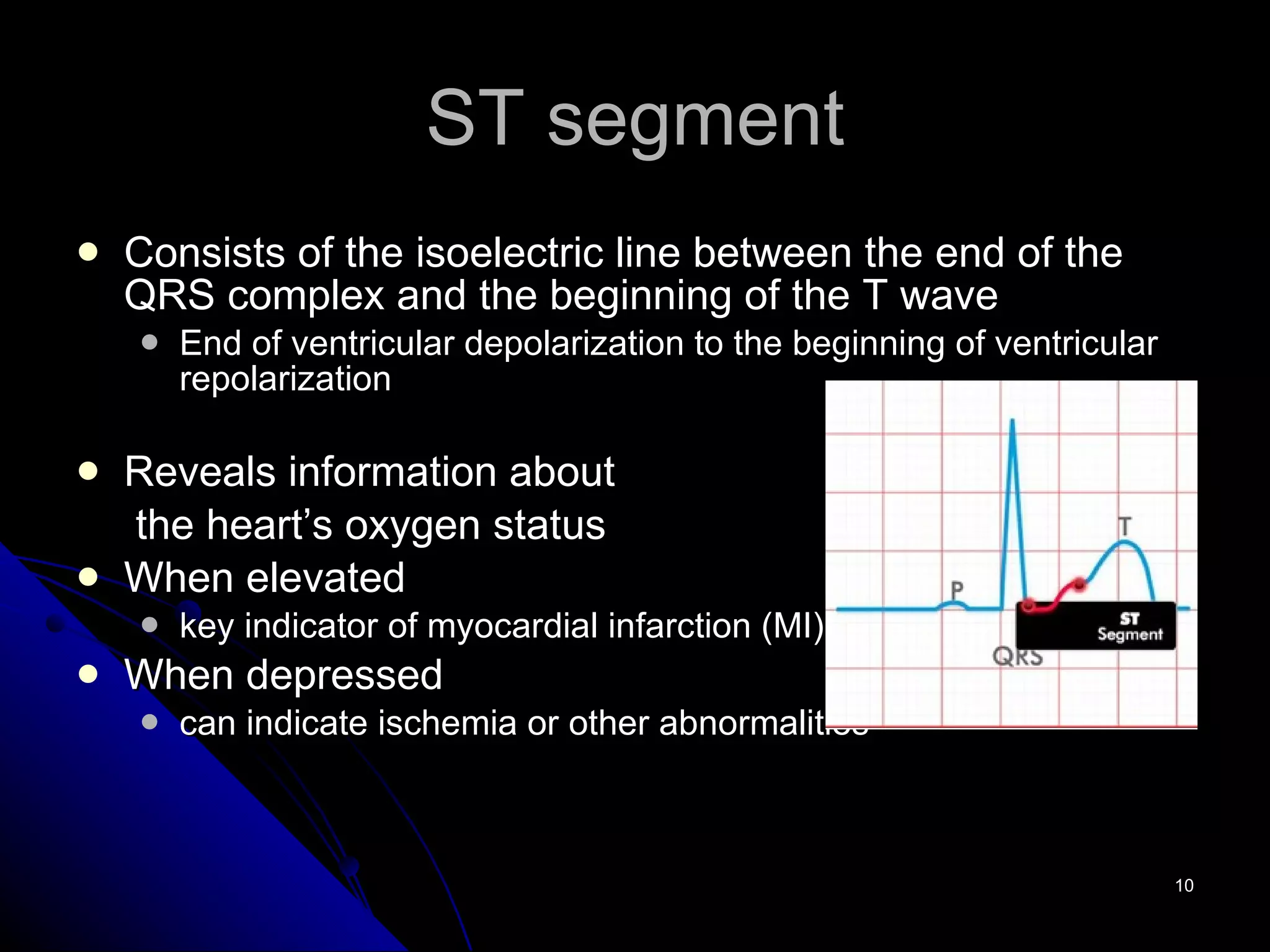 ST segment Consists of the isoelectric line between the end of the QRS complex and the beginning of the T wave End of ventricular depolarization to the beginning of ventricular repolarization Reveals information about  the heart’s oxygen status When elevated key indicator of myocardial infarction (MI) When depressed  can indicate ischemia or other abnormalities 