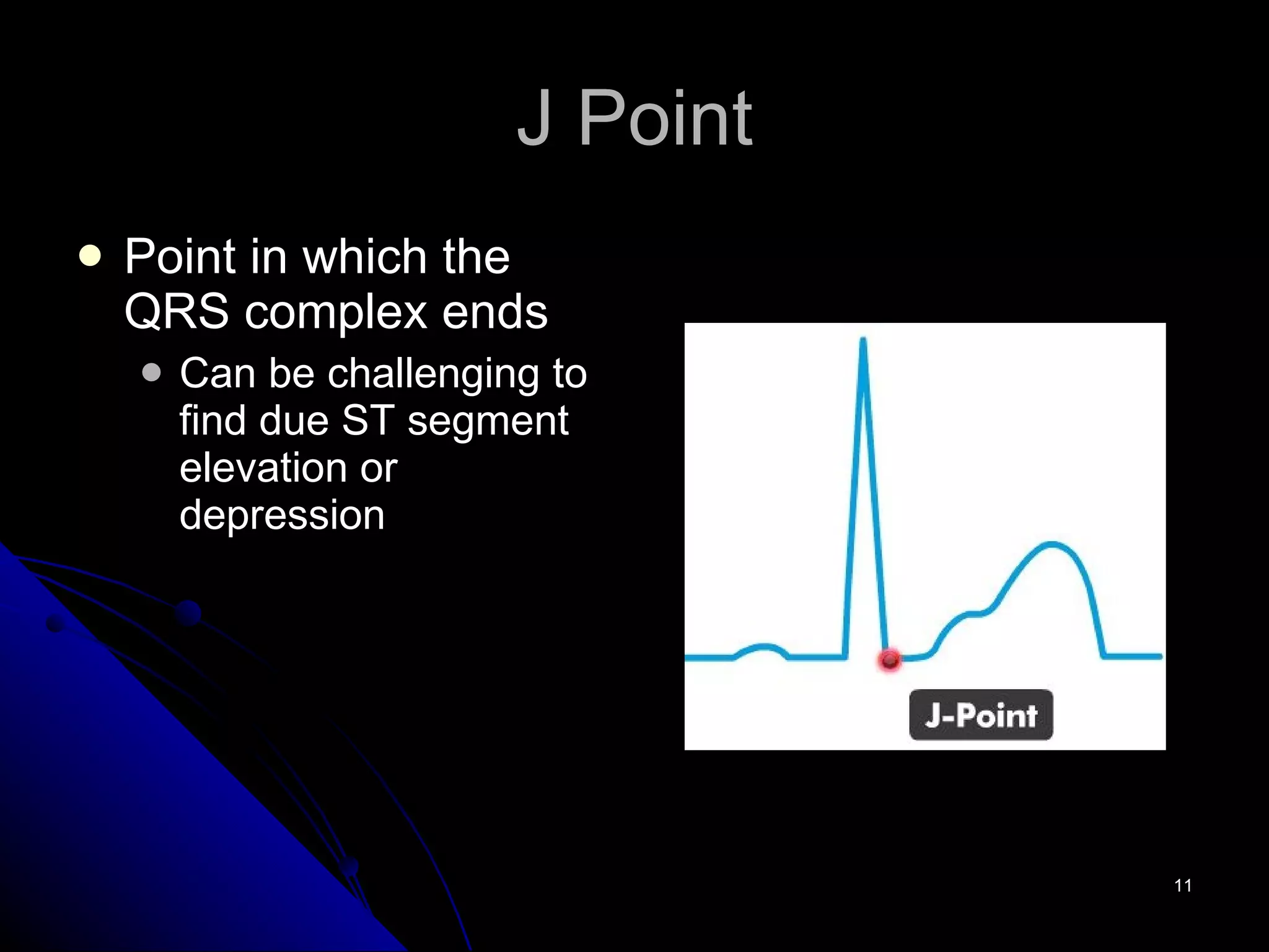 J Point Point in which the QRS complex ends Can be challenging to find due ST segment elevation or depression 