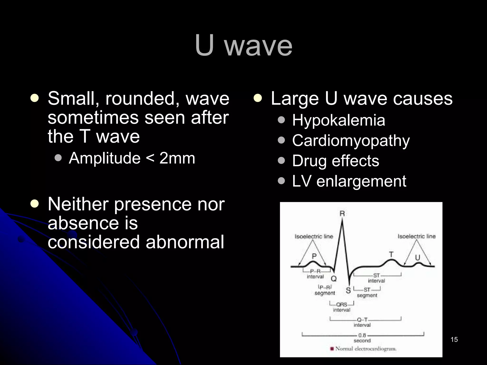 U wave Small, rounded, wave sometimes seen after the T wave Amplitude < 2mm  Neither presence nor absence is considered abnormal Large U wave causes Hypokalemia Cardiomyopathy Drug effects LV enlargement 