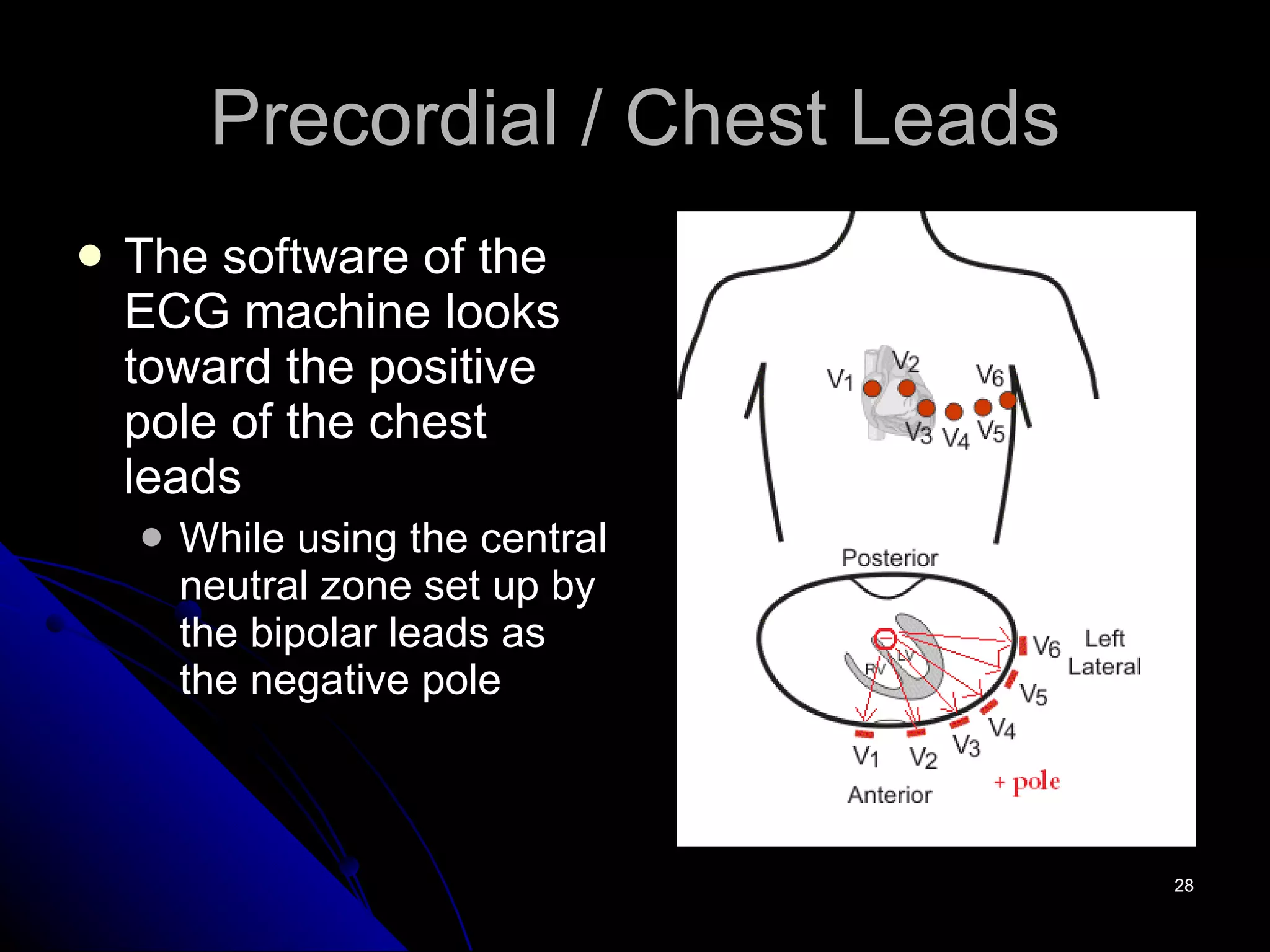 Precordial / Chest Leads The software of the ECG machine looks toward the positive pole of the chest leads While using the central neutral zone set up by the bipolar leads as the negative pole 