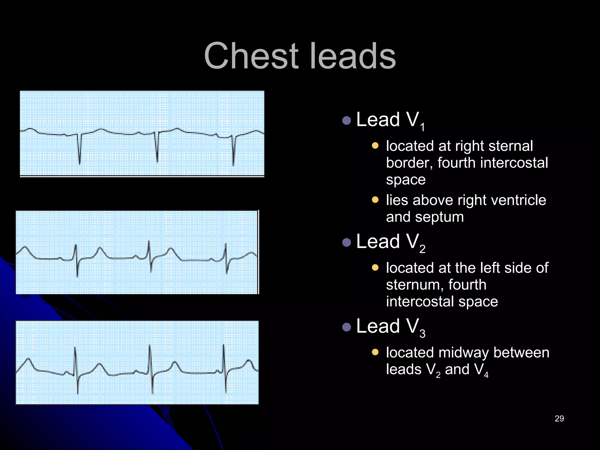 Chest leads Lead V 1 located at right sternal border, fourth intercostal space lies above right ventricle and septum Lead V 2 located at the left side of sternum, fourth intercostal space Lead V 3 located midway between leads V 2  and V 4 