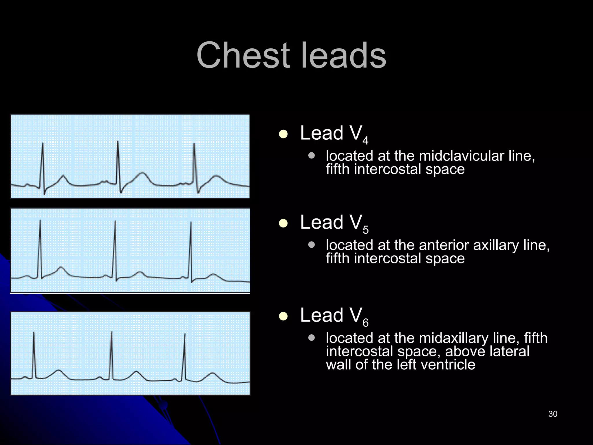Chest leads  Lead V 4 located at the midclavicular line, fifth intercostal space Lead V 5 located at the anterior axillary line, fifth intercostal space Lead V 6 located at the midaxillary line, fifth intercostal space, above lateral wall of the left ventricle 