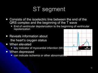 ST segment Consists of the isoelectric line between the end of the QRS complex and the beginning of the T wave End of ventricular depolarization to the beginning of ventricular repolarization Reveals information about  the heart’s oxygen status When elevated key indicator of myocardial infarction (MI) When depressed  can indicate ischemia or other abnormalities 