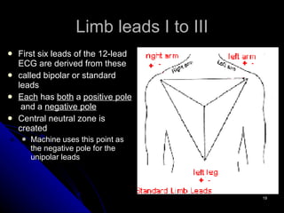 Limb leads I to III First six leads of the 12-lead ECG are derived from these  called bipolar or standard leads Each  has  both  a  positive pole   and a  negative pole Central neutral zone is created Machine uses this point as the negative pole for the unipolar leads 