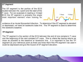 12 lead ecg | PPT